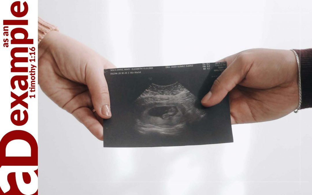 God’s ultrasound